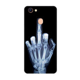For OPPO F5 Case 6.0'' Fashion Soft TPU Cases For OPPO F5 Youth Silicone Back Cover for OPPO F5 A73 A73T Phone Cases Fundas Capa